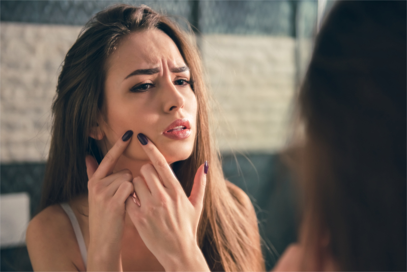 Behandeling van acne Behandeling van acne